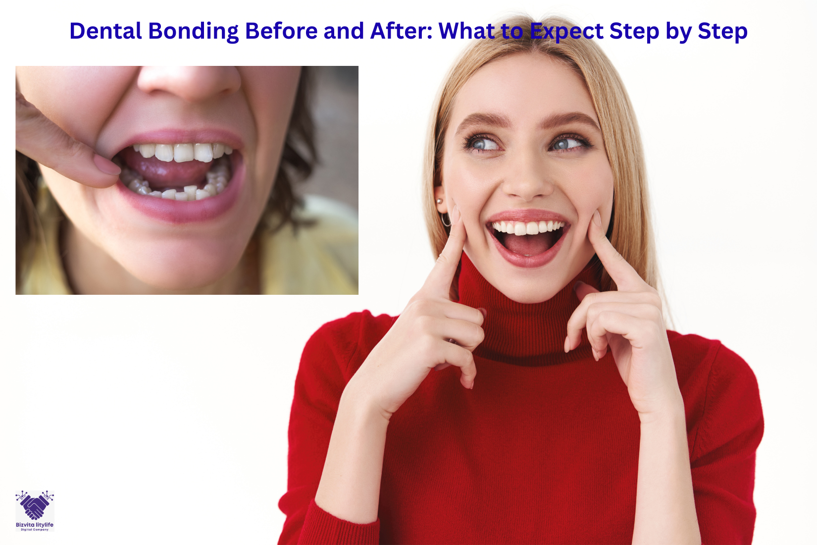 Dental Bonding Before and After